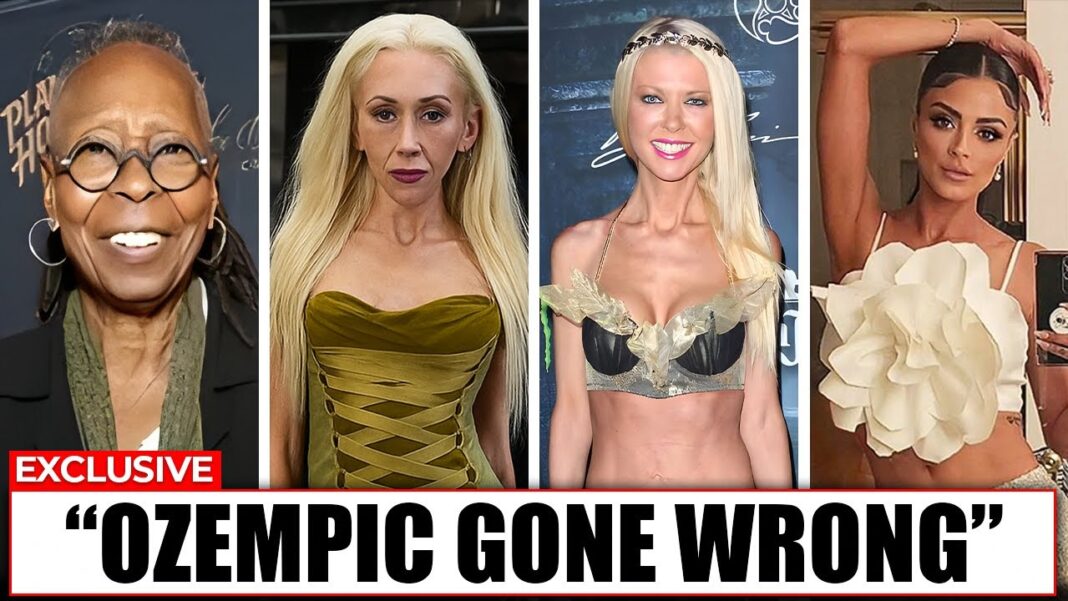 OZEMPIC GONE WRONG — Shocking Celebrity Transformations That Backfired